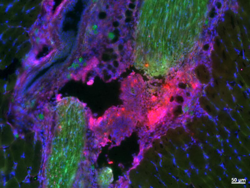 Fluoreszenzmikroskopische Aufnahme eines verletzten Gesichtsnerv (grün), welcher mit Nanofibrillen behandelt wurde (rot). Die Nanofibrillen haften in der Läsionsstelle zwischen den beiden Nervenden.