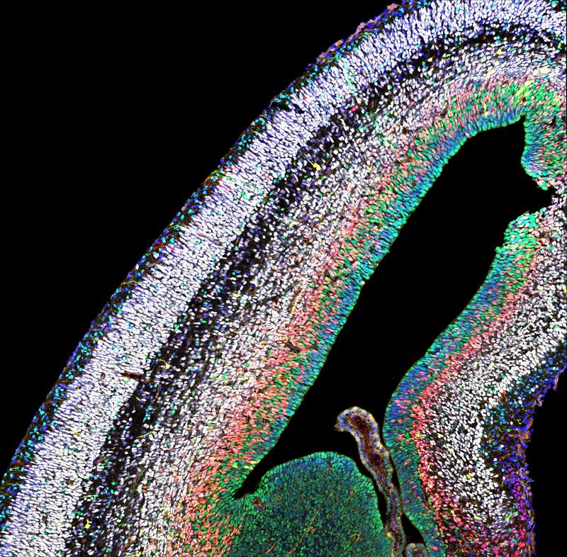 Konfokalmikroskopische Aufnahme des Cortex eines Mausembryos. Grün: Stammzellen; rot: Zwischenstadium; weiß: fertige Neuronen. Blau: Zellkerne. 