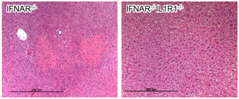 Histologie von IFNAR-defizienten Mäusen nach Behandlung mit leberschädigender RNA: Mäuse mit dem Interleukin-1β-Rezeptor entwickeln einen Leberschaden (links), Mäuse ohne (rechts) dagegen nicht. 