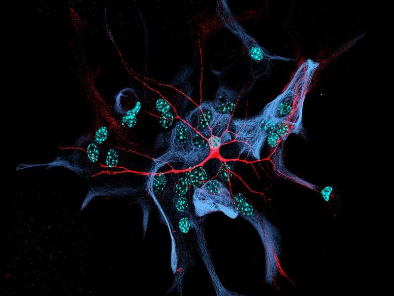 Zellmodell: Eine einzelne Nervenzelle (rot) ist auf einer Schicht von Astrozyten (blau) zu erkennen. 