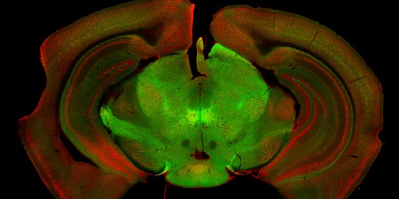 Zwei neuronale Zellpopulationen (grün, rot) in der Substantia nigra, die für die Steuerung der Bewegung verantwortlich sind.