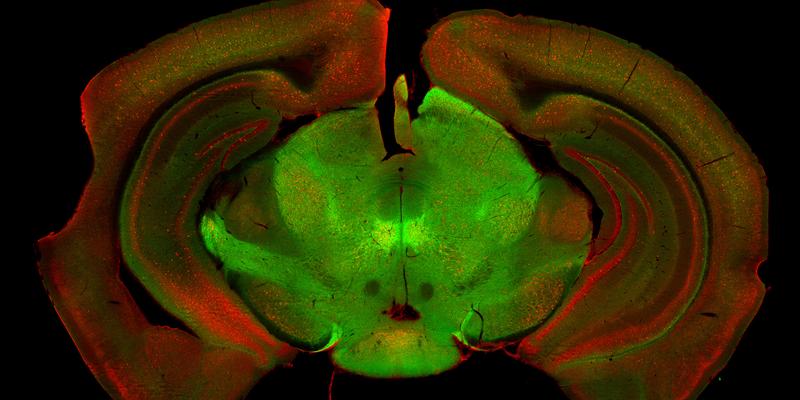 Two cell populations in the substantia nigra that are responsible for different aspects of locomotion.