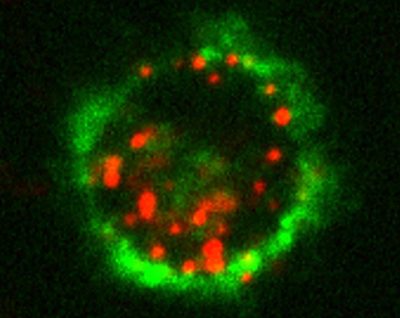 Querschnitt einer Langerhans Zelle, deren Membran grün eingefärbt wurde (Marker CD1a). Liposomen die ins Zellinnere aufgenommen wurden, sind hier rot dargestellt.