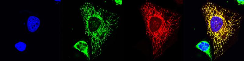 Ein großer Teil der Mikroproteine wandert nach ihrer Herstellung zu den Mitochondrien, den Kraftwerken der Zelle. Das Bild zeigt den Nachweis. 