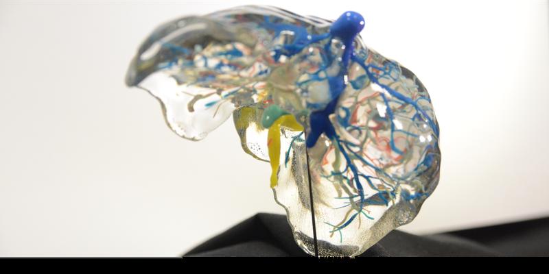 3D-Modell einer Leber.