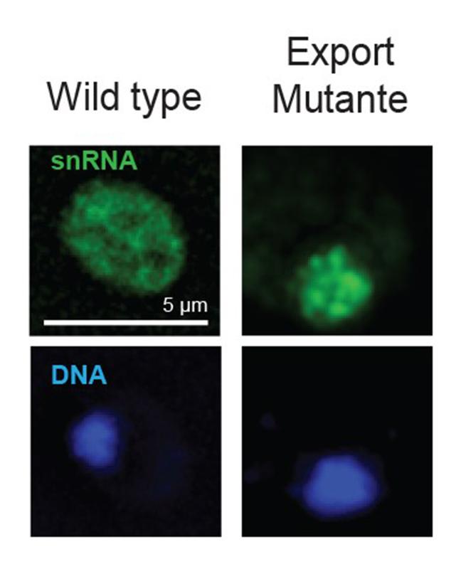 Nachweis der zytoplasmatischen snRNA in normalen (Wild type) Zellen im Cytoplasma und das „Festhalten“ diesen snRNAs in genetisch veränderten Zellen.