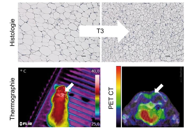 Schilddrüsenhormon (T3) führt zur Umwandlung von weissem Fettgewebe (oben links) in sogenanntes beiges Fettgewebe (oben rechts), welches die Fähigkeit besitzt, Körperfett in Wärme umzuwandeln. 