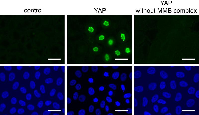 Cells divide after activation of YAP (green staining) – but only if the MMB protein complex is intact. 