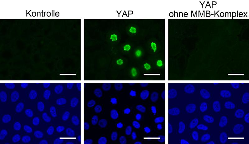 Zellen teilen sich nach der Aktivierung von YAP (grüne Färbung) – aber nur, wenn der MMB-Proteinkomplex intakt ist. 
