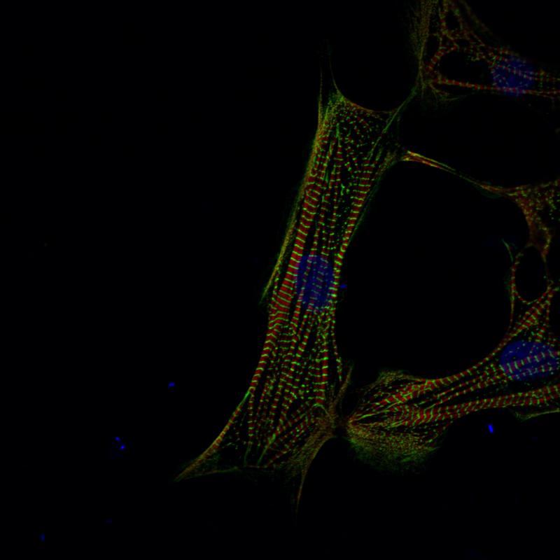 The picture shows human cardiomyocytes that were derived from induced pluripotent stem cells. 