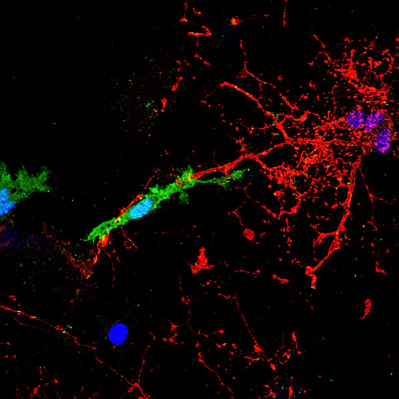 A microglial cell (green) contacts and attacks a myelinated axon (red). In the presence of the pHERV-W envelope protein, this interaction leads to axonal injury. The blue structures are cell nuclei.