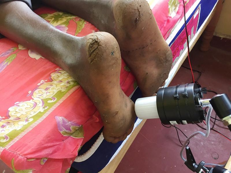 Forscher der TU Chemnitz untersuchen die Sensibilität der Fußsohle eines Probanden aus Kenia mit Hilfe eines sogenannten Shakers. 