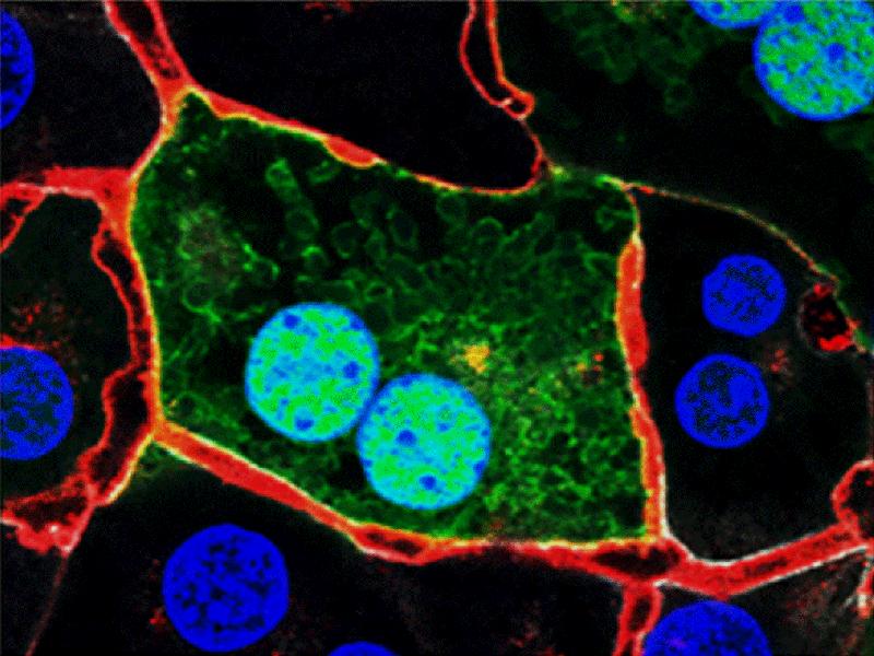  Leberzellen in der Kulturschale: In Grün der Zellkörper der Leberzelle, in Blau die Zellkerne, in Rot das Gallenkanälchen, in welches die Leberzelle Gallensalze und Fremdstoffe ausschüttet.