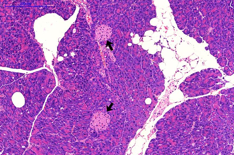 Fettzellen (weiß) und Langerhans-Inseln (schwarze Pfeile) in der Bauchspeicheldrüse einer diabetesanfälligen New Zealand Obese (NZO)-Maus. Lichtmikroskopische Aufnahme, Maßstab 200 Mikromet