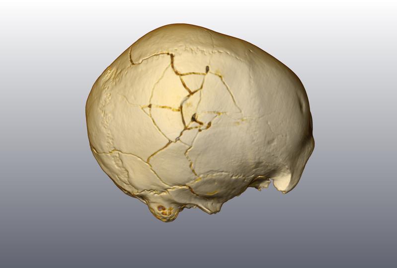 Zwei kleine Narben und eine größere Fraktur verlaufen über den 33.000 Jahre alten Frühmenschen-Schädel, der in der rumänischen Cioclovina-Höhle gefunden wurde 