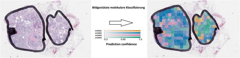 Das imCMS Modell kann die molekulare Klassifikation jeder einzelnen Bildregion neuer Patientenproben voraussagen und räumlich lokalisieren. Dieser Prozess dauert wenige Minuten.