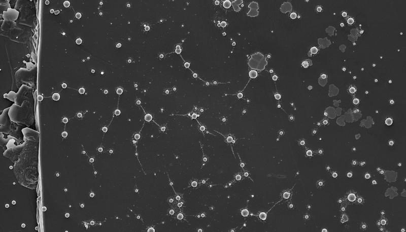 Wolframpolyoxometallate als lebenserhaltende anorganische Strukturen. Einzelzellen von M. sedula nach Kultivierung mit wolframhaltigem W-POM.