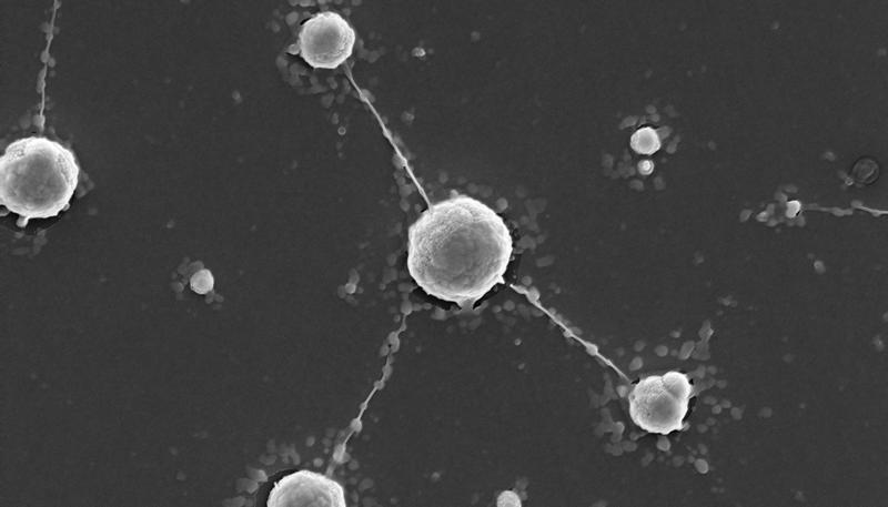 Auf wolframhaltigem W-POM kultivierte Kolonien von M. sedula bestehen aus einzelnen Zellen, die durch extrazelluläre Extensionen verbunden sind.