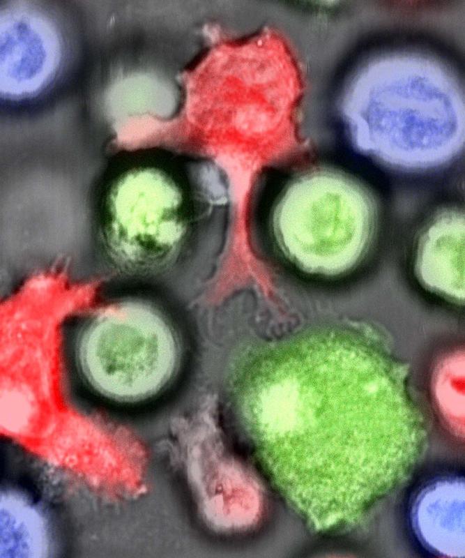 Natural killer cells (red) attack normal leukemia cells (green) but not leukemia stem cells (blue). 