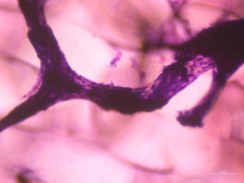 Eingefärbte Zellkultur (lila) auf dem neu entwickelten 3D-Silkongitter (im Hintergrund) nach der Differenzierung Richtung Knochenzelle
