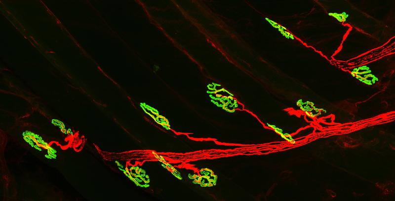 The neuromuscular junction (NMJ): innervation of the acetycholine receptors (green) on the muscle fiber by the motor neuron (red). 