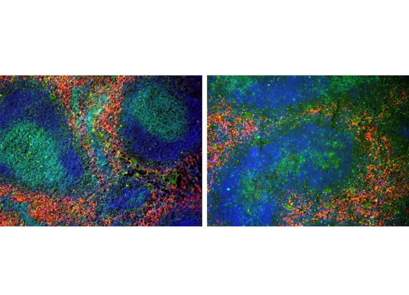 Nachweis von Immunzellen mittels spezifischen Antikörpern in Milzgewebeschnitten von wildtypischen Mäusen (links) und Mäusen mit defekter LRH-1-Expression in T Lymphozyten (rechts).