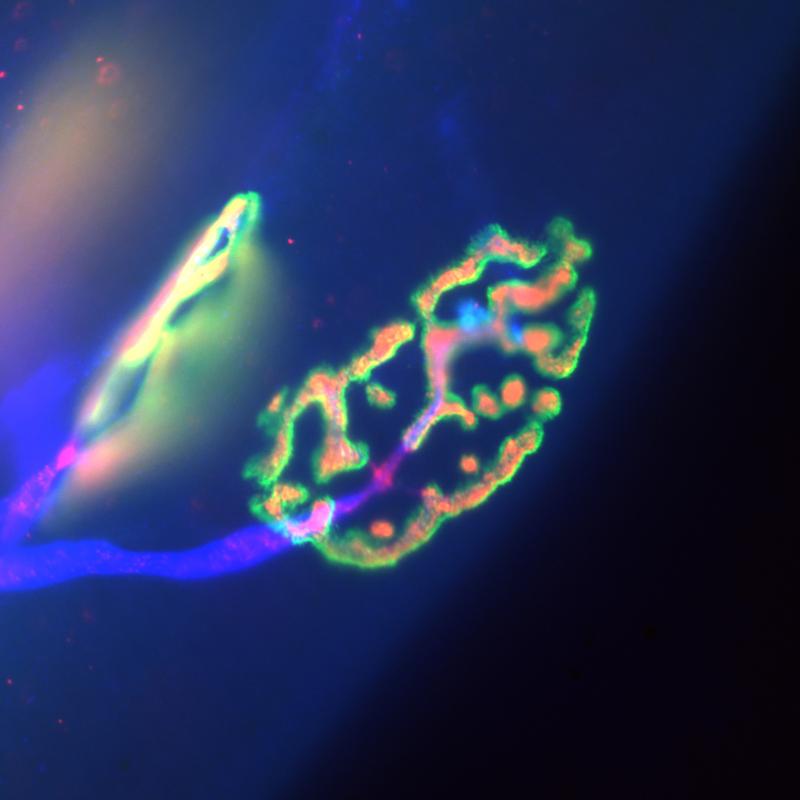 Proper neuromuscular junction: The nerve (blue) and its presynaptic nerve terminal (red) with the postsynaptic receptors in the skeletal muscle (green). 