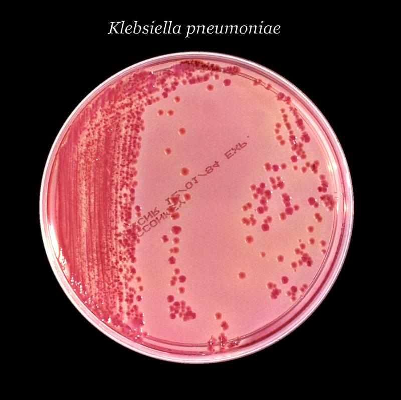 Das Bakterium Klebsiella pneumoniae gehört zu den häufigsten Erregern in Krankenhäusern.