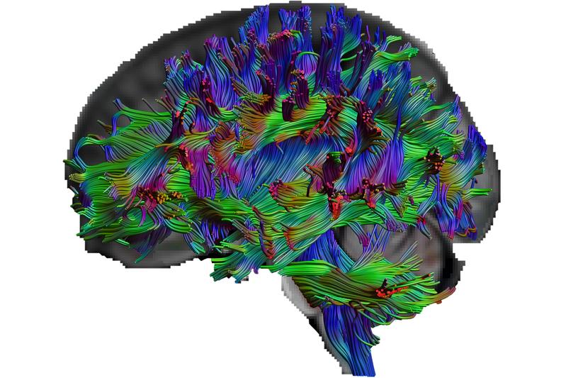 Mit der Diffusions-Tensor-Bildgebung können die Forscherinnen und Forscher die Nervenfasern im Gehirn sichtbar machen.