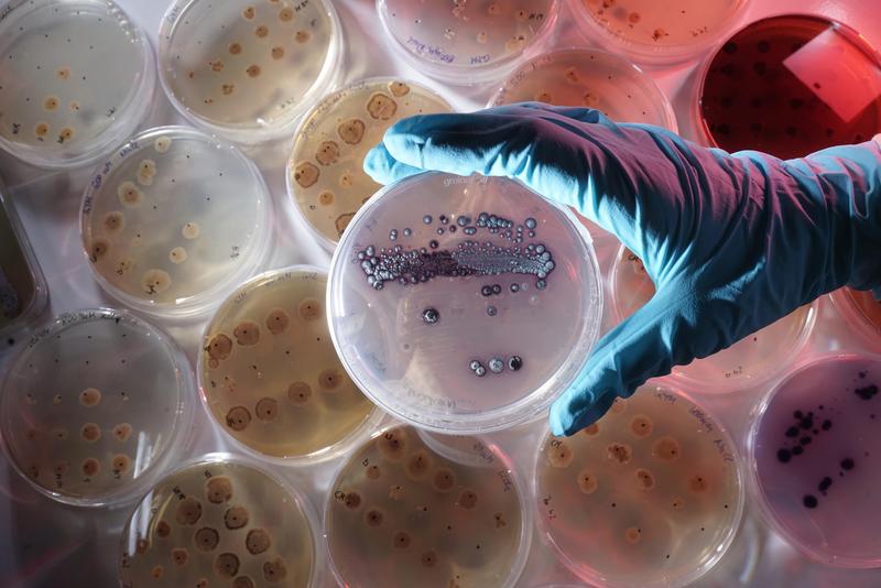 Researchers from University of Jena are looking for bacteria - in the picture: Petri dish with the bacterium Streptomyces lividans - that fix heavy metals dissolved in the soil as biominerals.