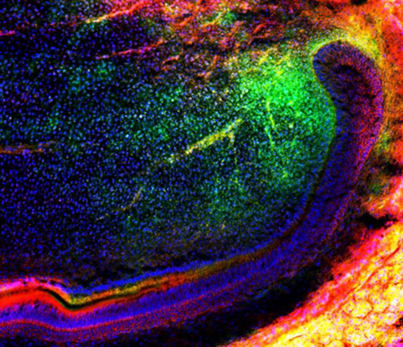 The image shows a group of mesenchymal (green) stem cells migrating in a tooth to further regenerate tissues. 