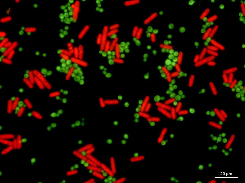 Kokultur von S. cerevisiae BY4741 GPD-EGFP (exprimiert EGFP, grüne runde Zellen) und S. pombe L972 adh1-tRFP (exprimiert tRFP, rote längliche Zellen)
