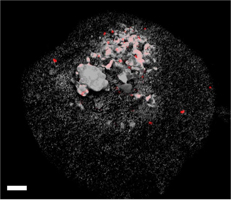 Epifluorescence microscopy picture of Methanoliparia-cells attached to a droplet of oil. The white scale bar represents a length of 10 micrometers. 