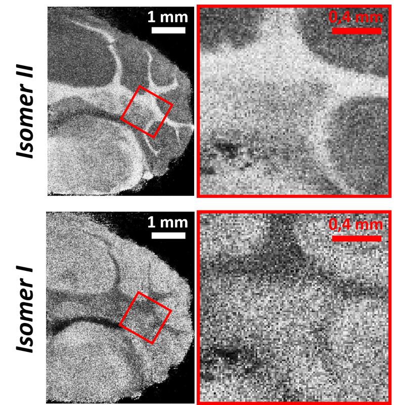 Mit der neuen Methode können Stoffwechselprodukte und Botenstoffe genau lokalisiert werden: Die beiden Isomere eines Metaboliten weisen unterschiedliche Verteilungen im Gewebe auf.