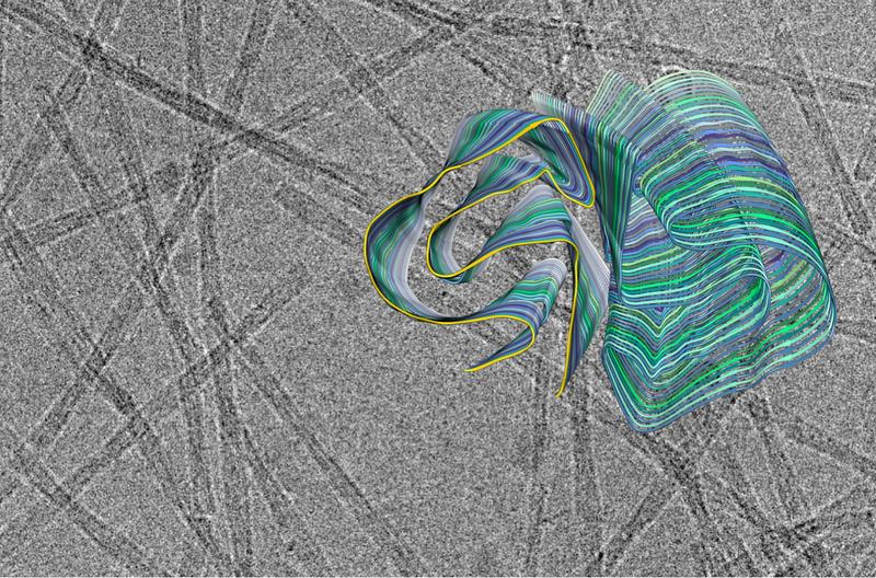 Querschnitt des 3D-Modells einer Amyloidfibrille vor dem Hintergrund einer Kryoelektronenmikroskopie-Aufnahme. Gelb hervorgehoben ist eine PI3K-SH3-Domäne.