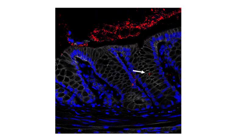 Entzündeter Dickdarm: Zellkerne in blau, Zellmembranen in weiß. In rot die Bakterien, die das gesamte Mikrobiom darstellen. Der Pfeil zeigt auf die Bakterien, die in die Krypten gelangt sind. 