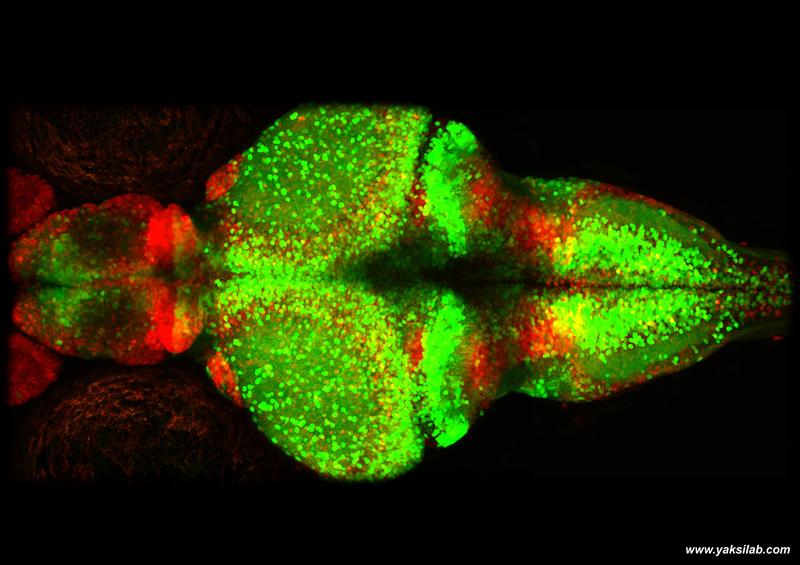 A microscopic view of a young zebrafish brain. Red indicates the glia cells and greens are neurons.