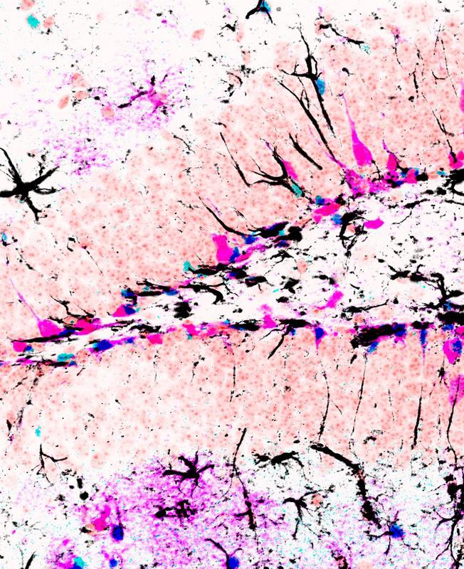 The image depicts Id4 (blue) and GFAP (black) expression in genetically labeled stem cells and their progeny (magenta) in the hippocampus of the mouse brain.