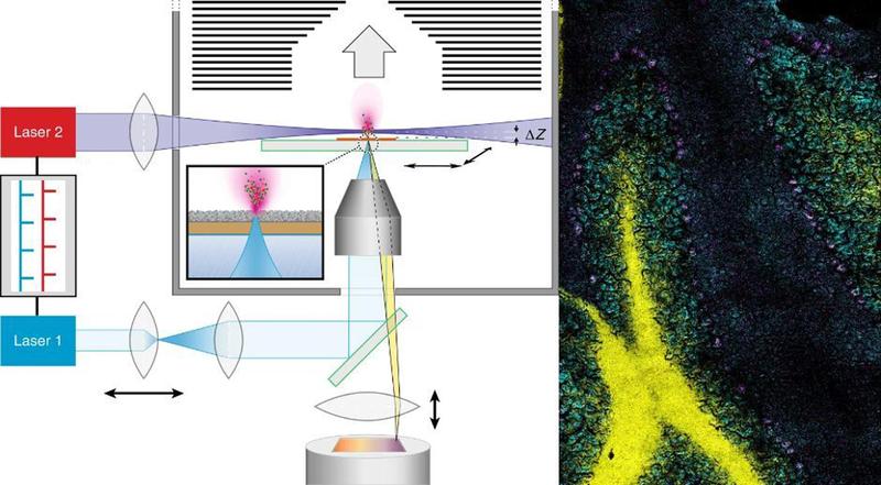 Left: how the t-MALDI-2-MS imaging method works. Right: an example, in which the complex structure of a mouse’s cerebellum is shown by means of the superimposition of three ion signals.