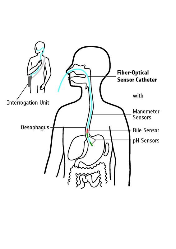 Katheter zur Untersuchung der Speiseröhre
