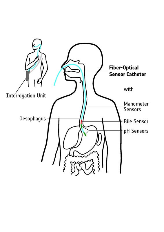Catheter for oesophagus examination