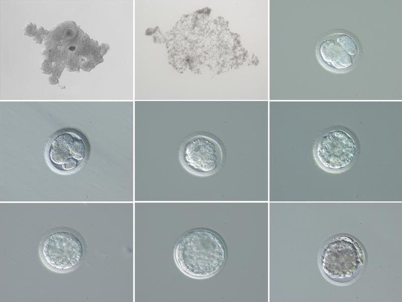 Entwicklung von Embryonen von Fatus Eizellen 