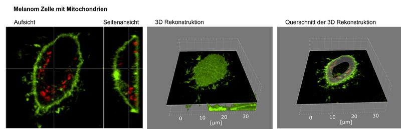 Fluoreszenz Mikroskopie Aufnahme von einer Melanom-Zelle (grün) mit Mitochondrien (rot) in Aufsicht und Seitenansicht. Von den Aufnahmen wurde eine 3D-Rekonstruktion angefertigt 