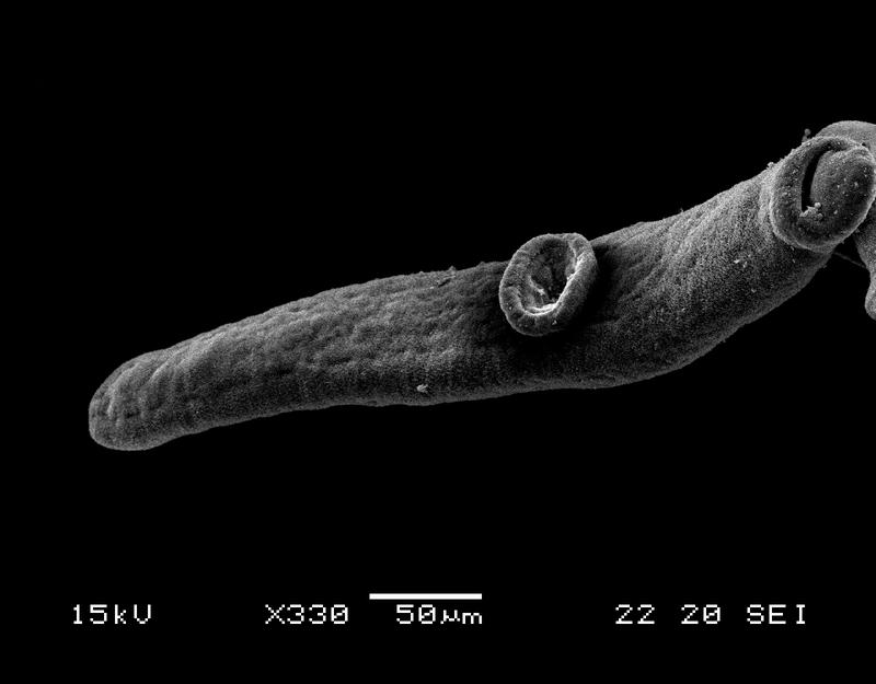Elektronenmikroskop-Aufnahme eines Pärchenegels. Infektionen mit diesen Parasiten können zu Leberzirrhosen führen. 