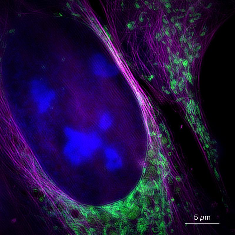 Diese Aufnahme des neuen Mikroskops zeigt eine lebende Knochenkrebszelle mit Zellkern (blau), Mitochondrien (grün) und Zytoskelett (magenta).