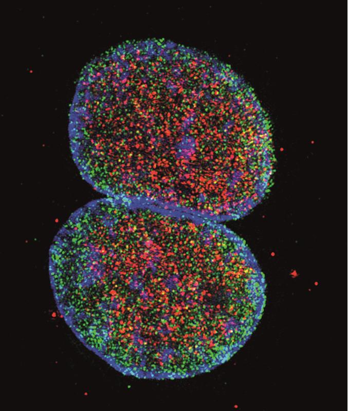 In menschlichen Immunzellen wurde die DNA im Zellkern (blau), sowie Virusproteine (grün) und die phosphorylierte, also inaktivierte Form von SAMHD1 (rot) angefärbt und mikroskopisch untersucht.