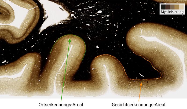 Eine höhere Myelinisierung (dunklerer Schatten) findet sich in dem Bereich des visuellen Kortex, der für die Gesichtserkennung verantwortlich ist - im Vergleich zum Bereich für die Ortserkennung. 