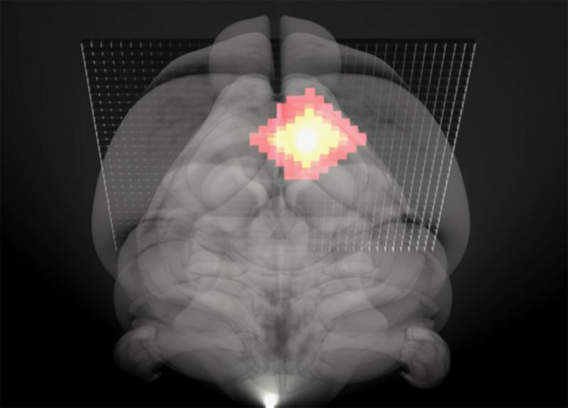 The new method may prove ideal for the prompt detection of ischemic onset, and can offer substantial insights into the neurobiology of various neurological disorders