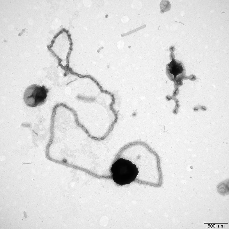 Elektronenmikroskopische Aufnahme einer langen Perlenkette an einem Flavobakterium. 