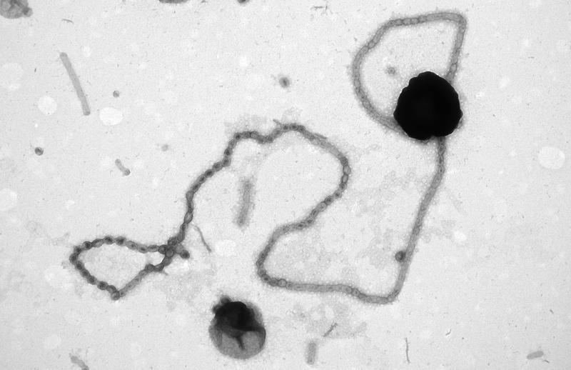 Electron microscope image of a long pearl chain on a flavobacterium. 